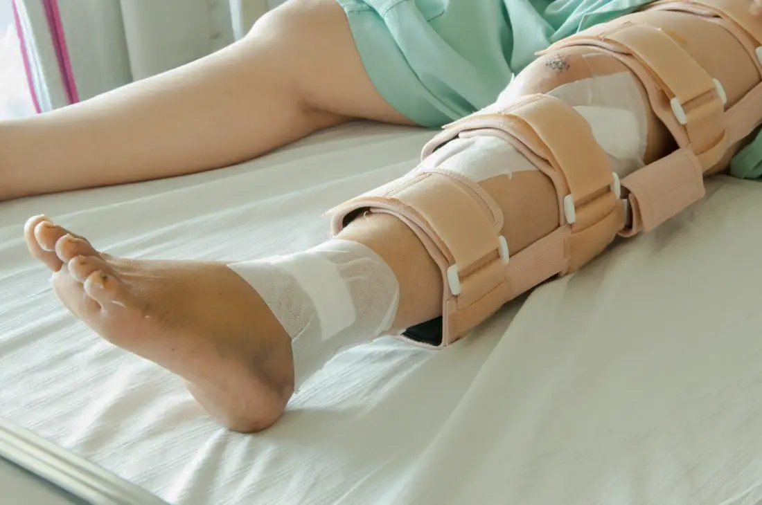 Fracture Care & Stabilization