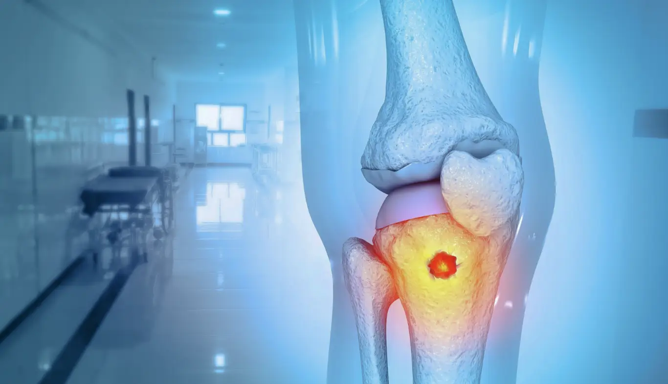 Bone Tumour Management (Orthopedic Oncology)